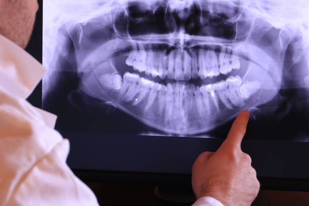 Best Chipped Tooth Repair Near Me  in Irvine, CA