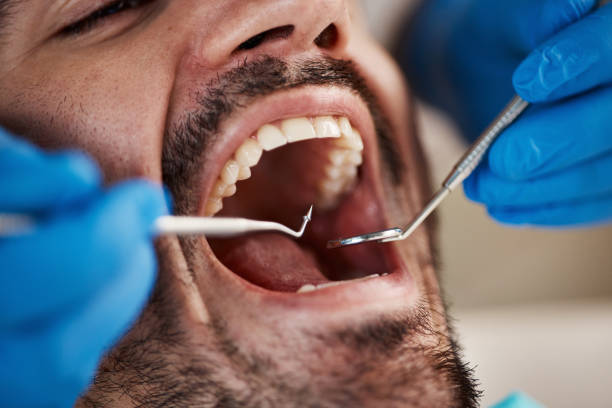 Best Cracked Tooth Emergency Dentist  in Irvine, CA