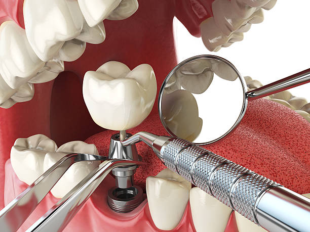 Best Emergency Tooth Extraction  in Irvine, CA